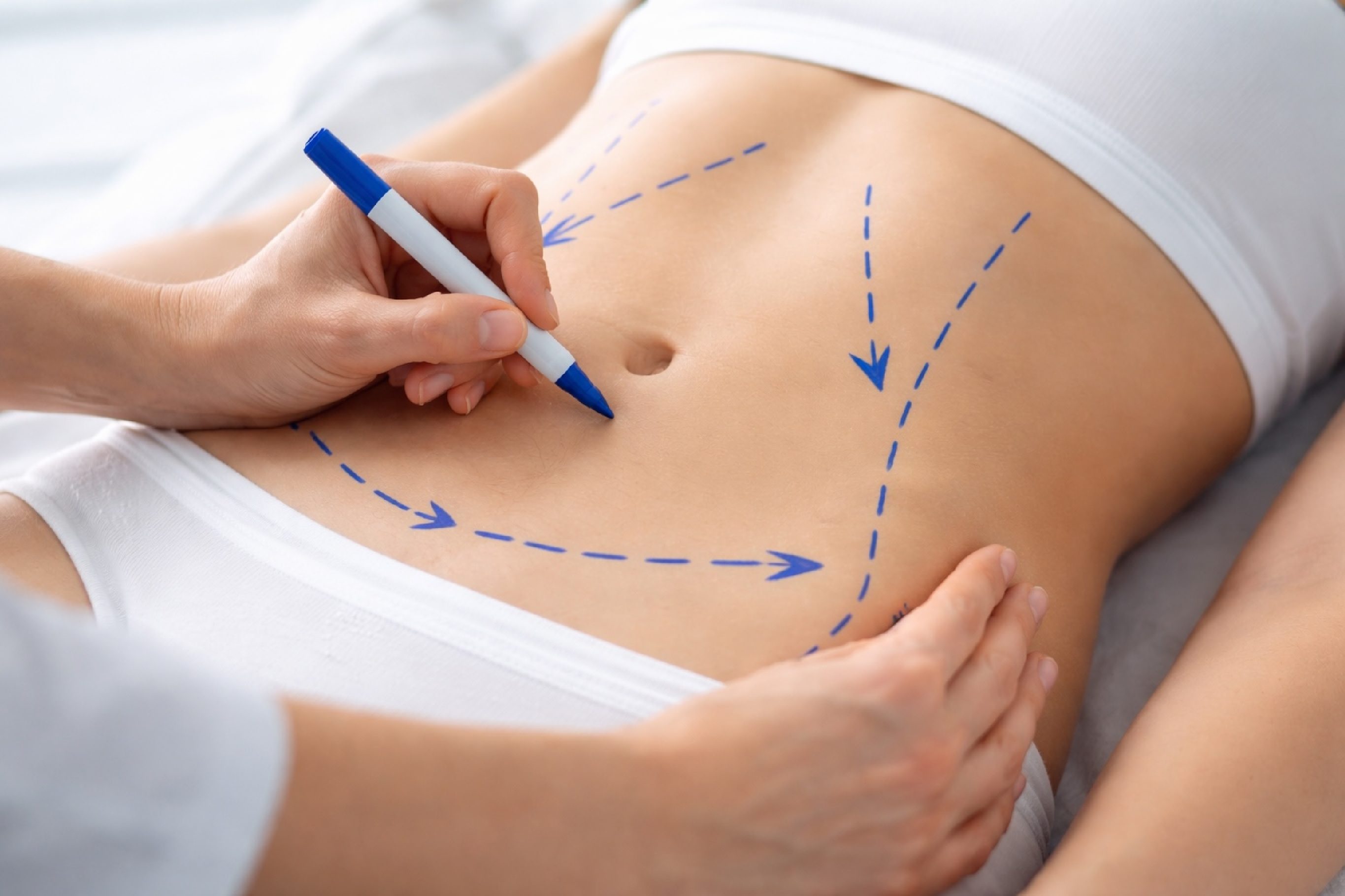 Formation Drainage Post Operatoire